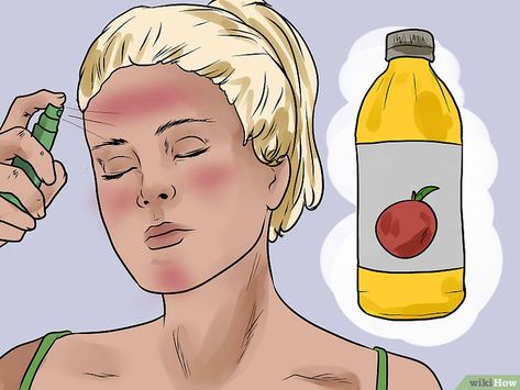 How to Prevent Skin Peeling After Sunburn: 14 Steps Sun Burn Remedy Face, Sunburn Face, Sunburnt Face, Sagging Skin Remedies, Skin Peeling On Face, Burn Remedy, Sunburn Peeling, Burn Relief, Skin Hacks