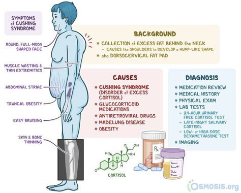 Immune Disorders, General Medicine, Neck Hump, Cushings Syndrome, Medical Study, Nursing 101, Student Tips, Study Essentials, Medical Student Study