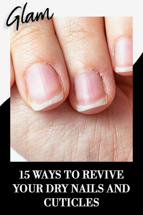 Cuticle Repair, Nail Remedies, Peeling Nails, Dry Cuticles, Nail Fungus Remedy, Nail Soak, Weak Nails, Nail Repair, Damaged Nails