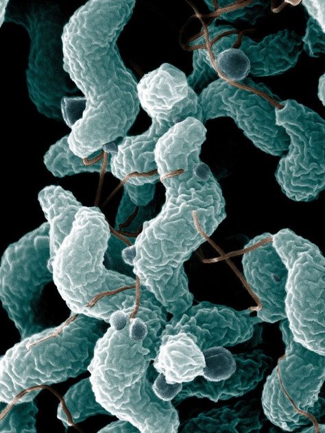 Epsilonproteobacteria - Wikipedia, the free encyclopedia Article Of The Week, Cognitive Decline, Guillain Barre Syndrome, Peripheral Nervous System, Electron Microscope, Muscle Weakness, Life Form, Healthy Aging, Health Articles