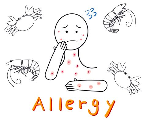 allergy, arm, body, crab, crustacean, disorder, face, food, food allergy, hives, ill, itch, pain, pruritus, rash, red, shrimp, skin, spot, urticaria, urtication Allergy Hives, Skin Allergy, Food Allergy, Skin Allergies, Crustaceans, Skin Food, Food Safety, Wall Art Canvas Prints, Food Food