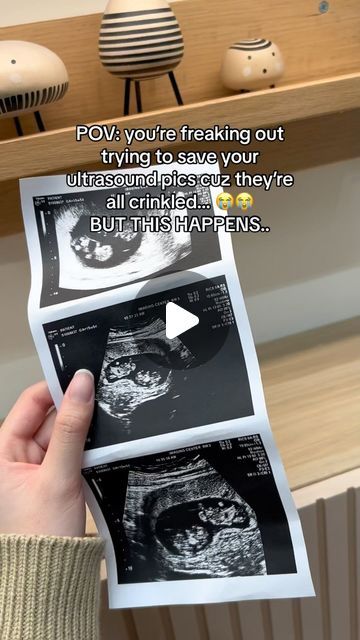 44K views · 1.2K likes | Snapframe | Live Ultrasound Frame on Instagram: "LlNK lN BlO to get your live ultrasound frame🥰✨" Things To Do With Ultrasound Pictures, How To Preserve Ultrasound Pictures, Ultrasound Pictures Display, Ultrasound Frame, Ultrasound Pictures, March 5, Ultrasound, Save Yourself, Frame