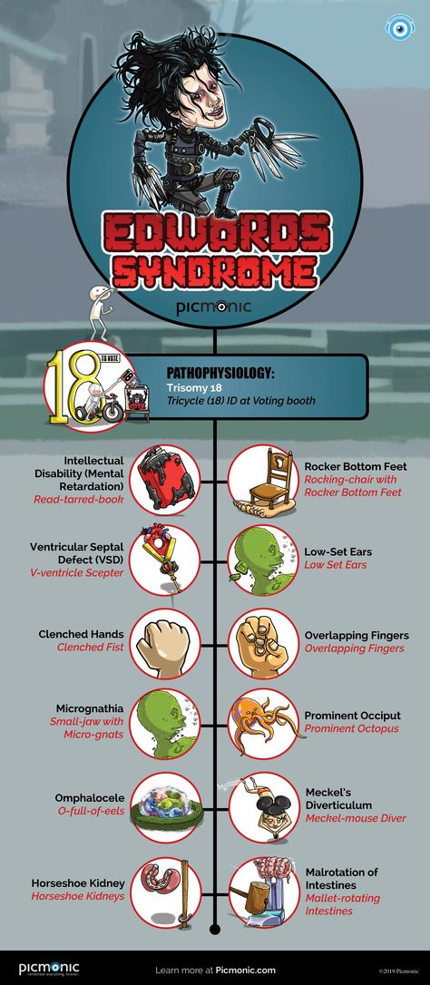 Edward Scissorhands teach us about Edwards Syndrome, a genetic syndrome due to the presence of a complete or partial extra copy of chromosome 18.  #edwardssyndrome #nclex #usmle #step1 #step2 #nursingschool #medschool #study #mnemonics #patho #pathophysiology #picmonic #nurse #doctor Edwards Syndrome, Medical Student Study, Pharmacology Nursing, Nursing School Tips, Nursing School Notes, Nurse Stuff, Science Topics, Edward Scissorhands, Nurse Doctor