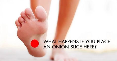 People Have Started Sleeping With Onions Under Their Feet Because It Does This To Their Body........So Onions are not just great in recipes.......Read about the many different benefits of using Onions therapeutically! Onion Feet Remedy, Onions On Feet Remedies, Onion On Feet Remedies Night, Onion In Sock, Onion Benefits Health, Benefits Of Sleep, Easy Detox, Going To Bed, Be Amazing