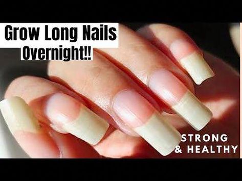 HOW TO GROW LONG NAILS FAST At Home DIY NATURAL NAIL GROWTH SERUM to Grow Long & Strong Nails (100% Works) Open For Details💕PRODUCTS MENTIONED:Lotion Linke... How To Get Long And Strong Nails, How To Have Long Healthy Nails, How To Grow Out Your Nails Overnight, How To Grow Your Nails With Vaseline, How To Get Longer Nails Overnight, Grow Your Nails Faster Overnight, How To Grow Your Nails Overnight, Mail Growth Tips, How To Grow Nails Overnight