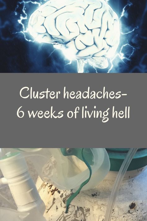 The perfect combination of treatments for cluster headaches Cluster Headache Causes, Cluster Headache Relief Instant, Cluster Headache Relief, Camphor Uses, Cluster Headache, Home Remedy For Headache, Headache Relief Instant, Headache Causes, Under The Weather