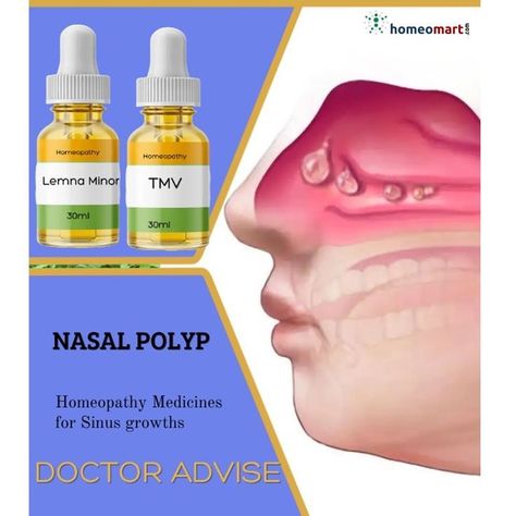 Sinus Polyps, Nasal Polyps, Sinus Remedies, Sinus Health, Medicine Kit, Homeopathy Remedies, Thuja Occidentalis, Homeopathy Medicine, Reduce Swelling