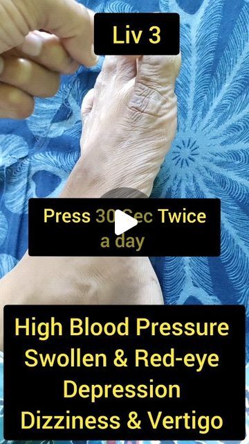 Rekha Khandelwal | Body Heat Remove. Acupressure Point For High Blood Pressure, Dizziness, Vertigo Many more Benefits.  #acupressure #pressurepoints... | Instagram Massage Cupping, Acupressure Point, Acupressure Massage, Pressure Point, Acupressure Points, Pressure Points, Acupressure, Body Heat, Red Eyes