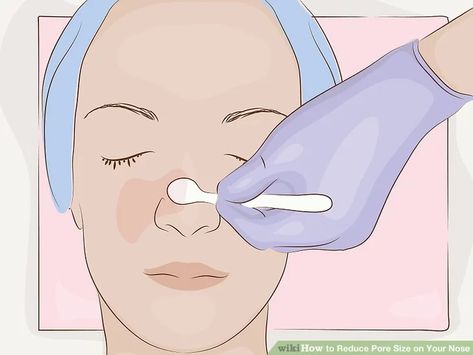 Clogged Pores On Nose, Large Pores On Nose, Pores On Nose, Oily Nose, Large Nose, Nose Pores, Reduce Pore Size, Smaller Pores, Reduce Pores