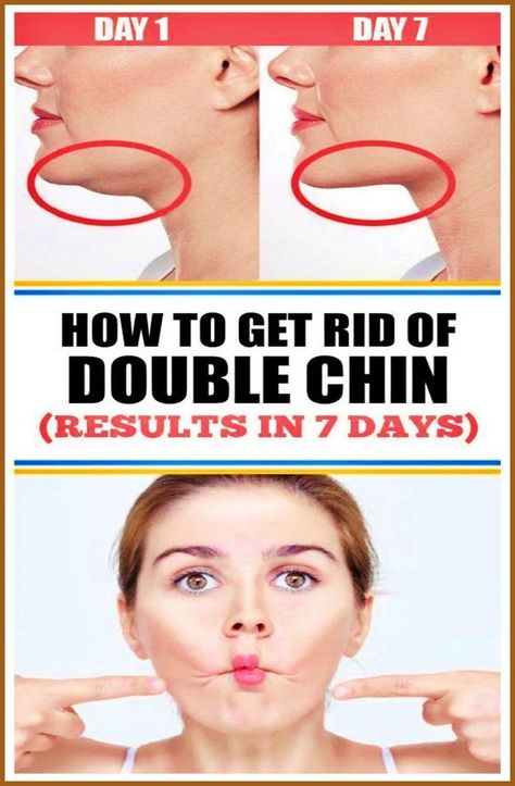 5 Exercises That Will Eliminate Your Double Chin Rid Of Double Chin, Chest Workout Women, Double Chin Exercises, Chin Exercises, Face Yoga Facial Exercises, Neck Exercises, Facial Yoga, Face Exercises, Facial Exercises