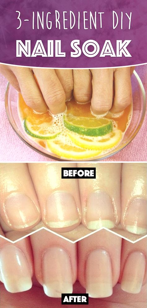 This 3-Ingredient DIY Nail Soak Miraculously Rejuvenates your Nails and Boosts their Growth! Diy Nail Soak, Do It Yourself Nails, Nail Soak, Nail Care Tips, How To Grow Nails, Brittle Nails, Nail Growth, Nail Fungus, Strong Nails