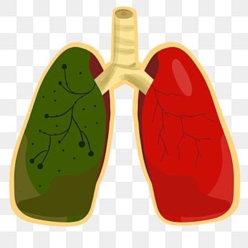 tbc,tuberculosis,tuberculosisday,tuberculosisillustration,tuberculosispicture Health Talk, Png Hd, Cartoon World, Anatomy Art, Clipart Images, Free Psd, Png Clipart, Free Png, Transparent Png