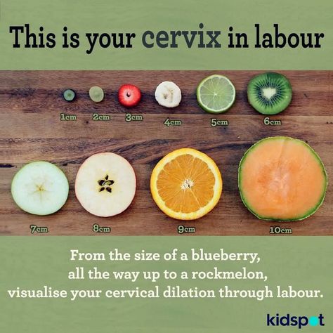 Cervix size during labor Dilation Chart, Cervix Dilation, Birth Education, Stages Of Labor, Pregnancy Labor, Childbirth Education, Birth Labor, Postpartum Care, Natural Birth