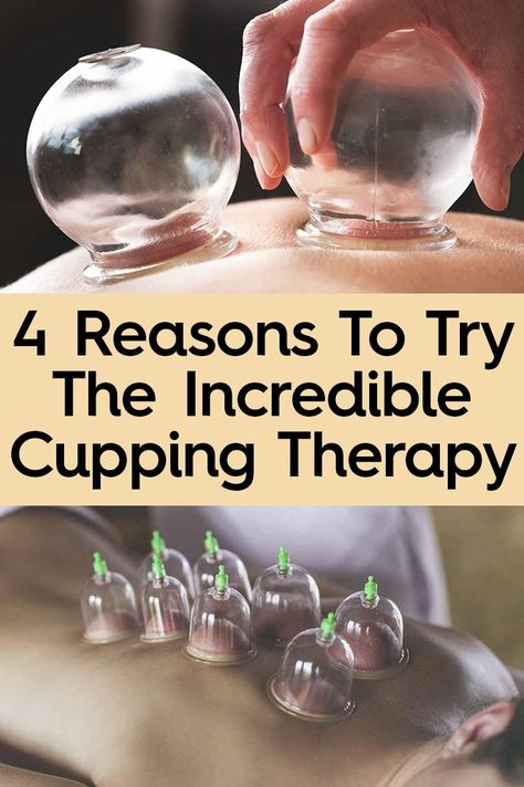 Cupping Benefits, Massage Cupping, Cupping Massage, Massage Therapy Techniques, Western Civilization, Cupping Therapy, Holistic Care, Massage Benefits, Holistic Remedies