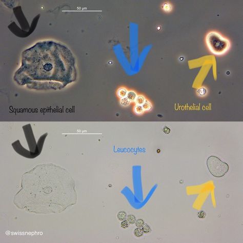 Microscope Laboratory, Medical Laboratory Technician, Acute Kidney Injury, Laboratory Technician, Medical Laboratory Science, The Routine, Laboratory Science, Medical Laboratory, Life Rules