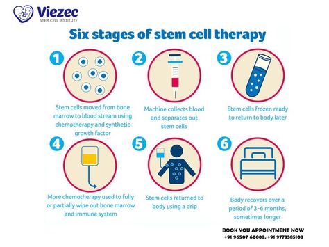 Six stages of stem cell therapy. #stemcell #Stemcelltherapy #Viezec #Viezecstemcell #Stemcelltherapyinindia #stemcellinindia #Beststemcell #stemcellsforthefuture #stemcelltransplant #stemcellresearch #stemcellgrowthfactor Cord Blood Banking, Stem Cell Research, Medical Facts, Spine Surgery, Cell Growth, Stem Cell Therapy, Cell Therapy, Regenerative Medicine, Growth Factor