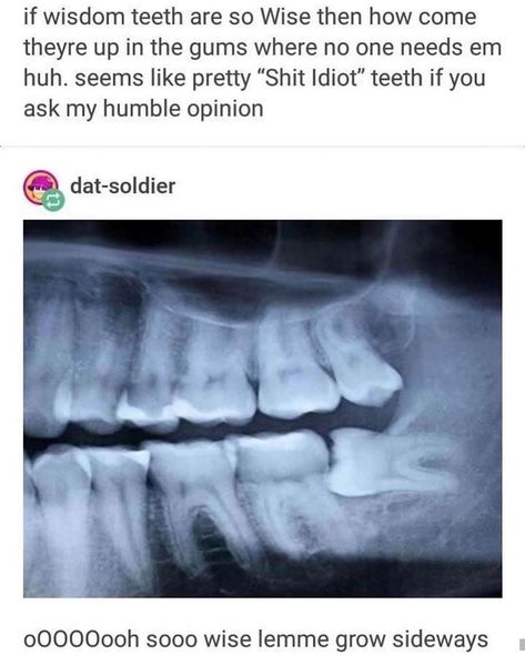 Wisdom Teeth Meme, Wisdom Teeth Quotes, Wisdom Teeth Funny, Um Actually, Spicy Memes, Dental Bridge, Canine Art, Dimension 20, Wisdom Teeth