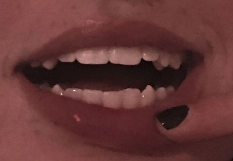 K9 Teeth Human Aesthetic, Teeth Aesthetic Grunge, Shifting Feature Claims, Cute Teeth Aesthetic, Teeth Claims For Dr Sharp, Pretty Teeth With Fangs, Natural Sharp Teeth, Sharp K9 Teeth Human, Dr Scar Claims