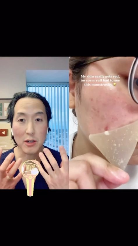 tonyyounmd on Instagram: Hydrocolloid patches as spot treatments for pimples! Combine with a healthy diet, clean skin care, and a visit to your local dermatologist… Hydrocolloid Patches, Clean Skin Care, Prevent Pimples, Cold Sore, Clean Skincare, Simple Skincare, Clean Skin, Physical Fitness, Healthy Diet