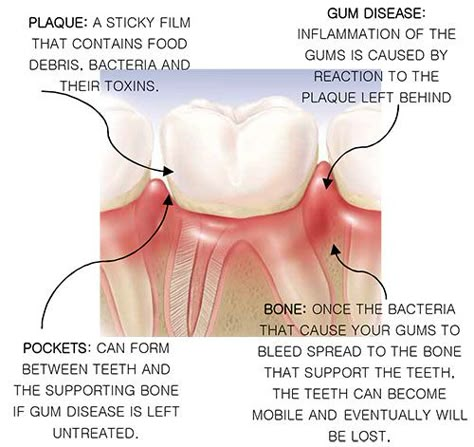 Dental Terminology Cheat Sheet, Dental Abbreviations, Dental Therapist, Dental Assistant Study Guide, Dental Charting, Dental Terminology, Dental Assistant School, Dental Hygienist School, Dental Practice Management