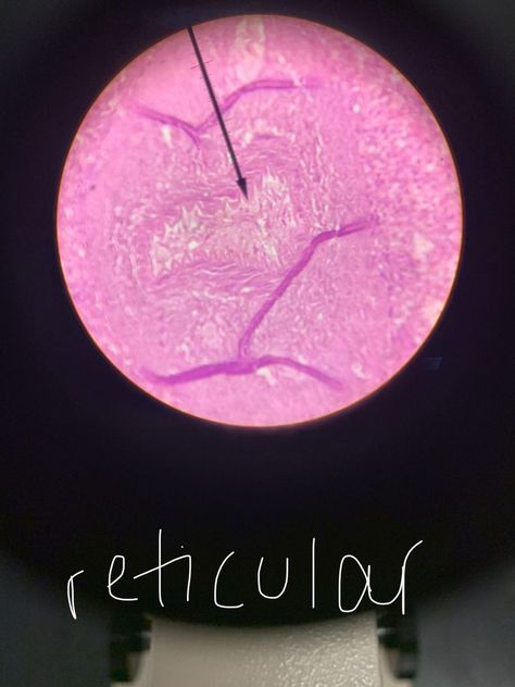 Reticular is a loose connective tissue with collagenous fibers to provide organization and structure. It can be found in the spleen and liver. Loose Connective Tissue, Tissue Types, Like Chicken, Connective Tissue, The Liver, Chicken Wire, Anatomy And Physiology, Chicken