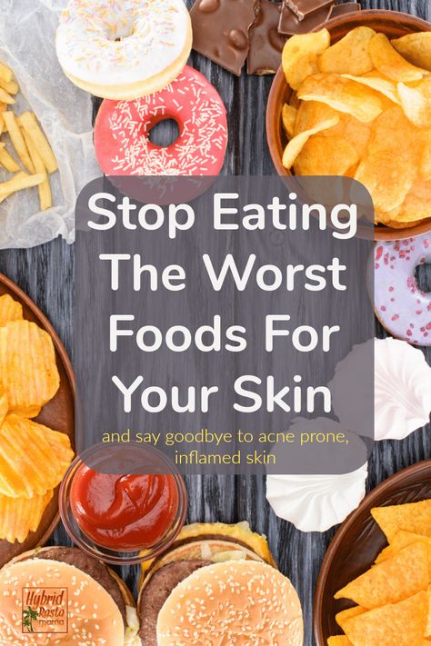 Skin food. Yes, you are what you eat and what you eat is a reflection of your skin health. Learn more about the worst foods for your skin, how poor diet affects your skin, foods that inflame skin, what foods are bad for acne prone skin, and how to repair problem skin. #skincare #acne #healthyskin From HybridRastaMama.com Food For Acne, Foods For Skin, Foods For Clear Skin, Skin Foods, Clear Skin Diet, Foods For Healthy Skin, Bad Acne, Problem Skin, Skincare Acne