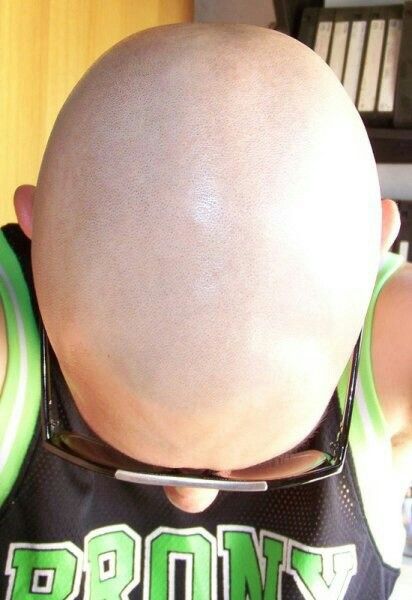 Shiny shaved head. Bald Head Man, Bald Hairstyles For Women, Bald Hairstyles, Girls With Shaved Heads, Bald Head Women, Bald Look, Bald Men Style, Shaved Hair Cuts, Half Shaved Hair