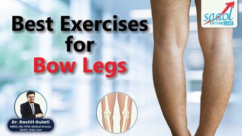 Dr Divakar KumarPhysiotherapist at SAAOL Ortho Care in this video will tell you about some exercises and stretching for knee deformities to perform at your... Bow Legs Correction Exercise, Knee Massage, Bow Legged Correction, Human Legs, Plant Styling, Bow Legged, Leg Yoga, All Body Workout, Leg Cramps