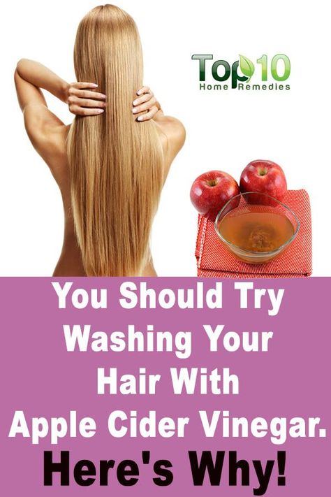 Home Remedy For Dandruff, Remedy For Dandruff, Apple Cider Vinegar Acne, Home Remedies For Dandruff, Vinegar For Hair, Apple Cider Vinegar For Skin, Benefits Of Apple Cider Vinegar, Benefits Of Apple Cider, Benefits Of Apple