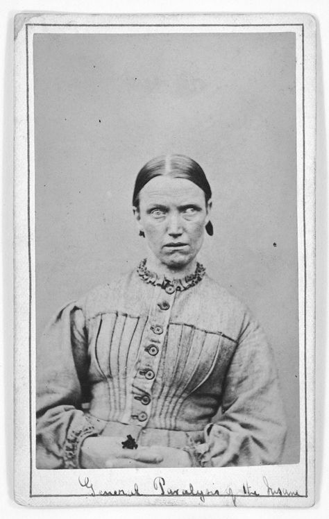 Portraits from an English 'lunatic asylum' circa 1869 Victorian Asylum, Asylum Patient, Insane Asylum Patients, Haunted Photos, Disturbing Photos, Physically Disabled, Photographic Portraits, Images Terrifiantes, 1860s Dresses