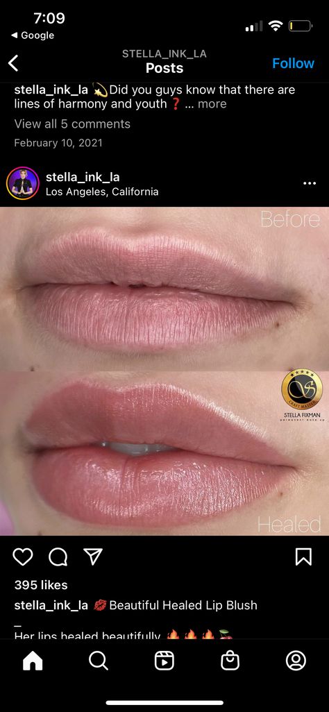 Lip Blush Natural, Lip Filler Natural Look, Healed Lip Blush, Lip Blushing Colors, .5 Lip Filler, Light Lip Filler, Subtle Lip Filler Before And After, Lip Blushing Tattoo Before And After, Lip Pmu