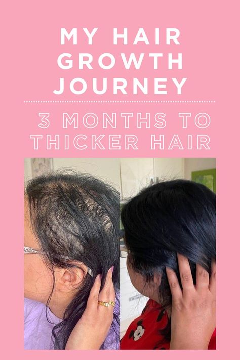 Images showcasing before and after of hair growth journey to fuller and thicker hair. Hair Growth Journey, Grow Thicker Hair, Hair Growth Women, Grow Gorgeous, Thicker Hair, Hair Solutions, Hair Density, Thinning Hair, Grow Hair