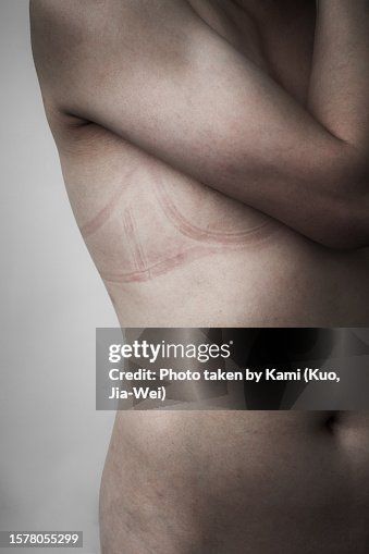 The skin has imprints left by wearing a tight bra. Skin Imprints, Tight Bra, Free Stock Photos Image, The Skin, The Body, Royalty Free Images, Getty Images, Tights, Royalty Free Stock Photos