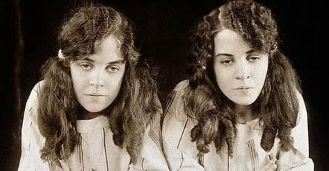 Conjoined twins Daisy and Violet Hilton were born in the early 1900s in England. Referred to as Siamese Twins, the Hilton sisters were connected at the hips and but... Daisy And Violet Hilton, Among The Sleep, Human Oddities, Dark Circus, Conjoined Twins, Little Misfortune, Corpse Party, Lifestyle Hack, Vintage Twins