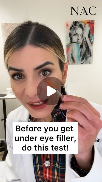 Under Eye Plumper, Hallow Undereye, Under Eye Hollows Remedies, Eye Fillers Before And After, Sunken Eyes Aesthetic, Hollow Eyes Remedy, Filler Under Eyes Before And After, Sunken Eyes Remedy, Puffy Under Eyes Bags