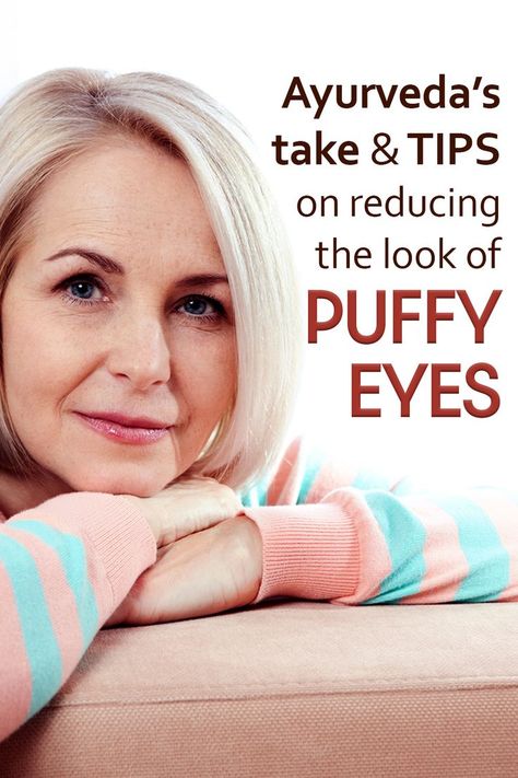 Want to get Rid of Puffy Eyes? Know Ultimate Ayurvedic Tips that work! / Puffy eyes / The Ayurveda Experience Swollen Eye Remedies, Skin Tightening Exercises, Eye Wrinkles Remedies, Undereye Bags Remedy, Puffy Eyes Remedy, The Ayurveda Experience, Ayurvedic Tips, Swollen Eyes, Wrinkle Remedies