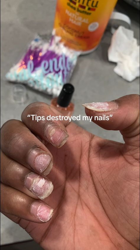 #May_Nail_Designs #Nail_Growth_Tips #Builder_Gel_Nails #Natural_Nail_Designs May Nail Designs, Winter Nail Art Ideas, Natural Nail Care, Builder Gel Nails, Acrylic Toe Nails, May Nails, Gel Nails Diy, Nail Care Tips, Nail Care Routine