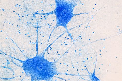 #TrendingWithImpact: In a new #editorial paper, researcher Hana Hall from @lifeatpurdue discusses the role of R-loops in neuronal #aging and #neurodegeneration. On September 13, 2023, her editorial was published in Aging (Aging-US), and entitled, “R-loops in neuronal aging.” Visit Aging-US.com to read the full editorial in Volume 15, Issue 17. Short on time? Read a blog synopsis at Aging-US.org. #neurons #openaccess #peerreviewed #medEd #OA Types Of Neurons, Guillain Barre, Glial Cells, Guillain Barre Syndrome, Cell Forms, Motor Neuron, Under The Microscope, Nerve Fiber, Microscopes