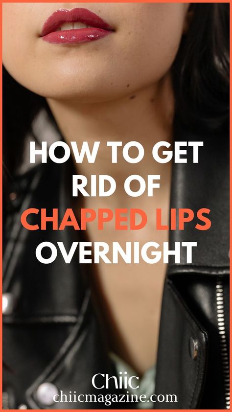 Home Remedies to Get Rid Of Chapped Lips Overnight Dry Lips Remedy, Chapped Lips Remedy, Natural Remedies For Migraines, Beauty Culture, Lip Care Routine, Dry Skin Remedies, Home Remedies For Hair, Natural Sleep Remedies, A Rat