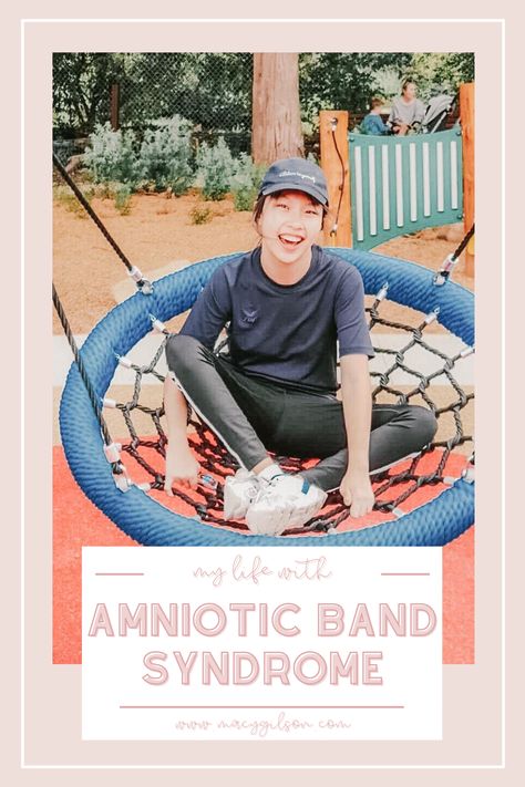 amniotic band syndrome | limb difference | disability advocate | special education | Emily Ong Itband Syndrome, Plica Syndrome Exercises, Malicious Parent Syndrome, Amniotic Band Syndrome, Littermate Syndrome, Limb Difference, Differently Abled, Physical Education Lessons, Bad Parents