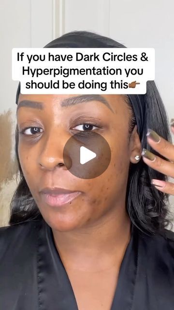 Lighten Dark Circles Under Eyes, Eye Makeup For Dark Skin Tones, Concealer Tricks For Dark Circles, Best Concealer For Brown Skin, Dark Undereyes Makeup, Dark Spot Corrector Makeup, Color Correcting Dark Circles Under Eyes, Under Eyes Dark Circles, Hiding Dark Circles Under Eyes