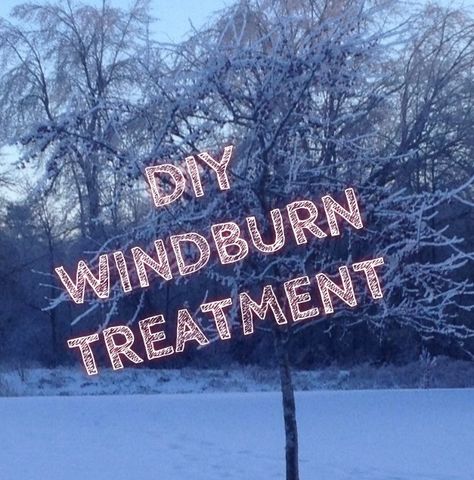 How To Treat a Windburn like a Boss – Style Context How To Burn Cinnamon Sticks, Vinegar For Sunburn Relief, Treating Sunburn, How To Treat Sunburn, Burn Remedy, Sunburn Meme, Boss Style, Diy Remedies, Cracked Skin