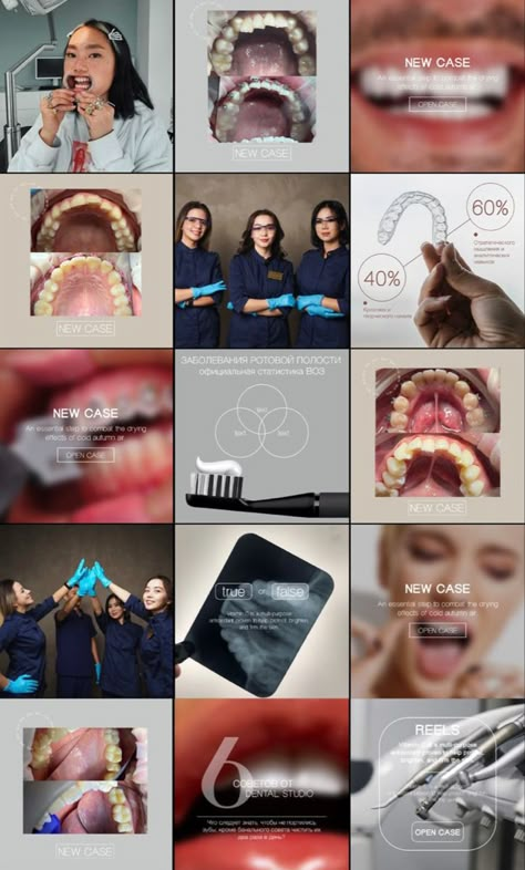 Dental Post, Dentist Social Media, Dentist Branding, Dental World, Dental Posts, Social Media Branding Design, Aesthetic Medicine, Set Designs, Social Media Branding