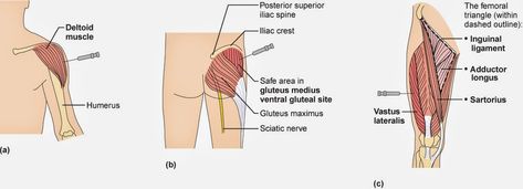 vitamin b12 injection sites Gluteal Injection Site, Intramuscular Injection Sites, Im Injection Sites, Depo Injection, Vitamin B Injections, Vitamin Injections, Injection Sites, Im Injection, Vitamin B12 Injections