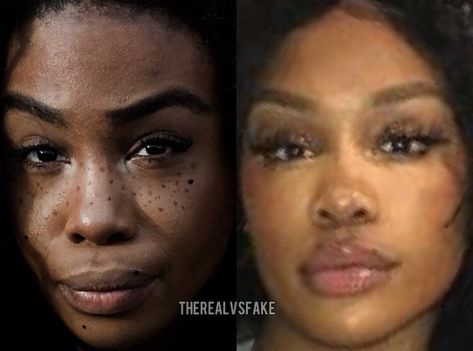 Sza Singer Before And After Surgery, Sza Singer Nose Contour, Reality Vs Instagram, Dream Nose, Ethnic Rhinoplasty, Sza Singer, Filters Instagram, Nose Contour, Digital Computer