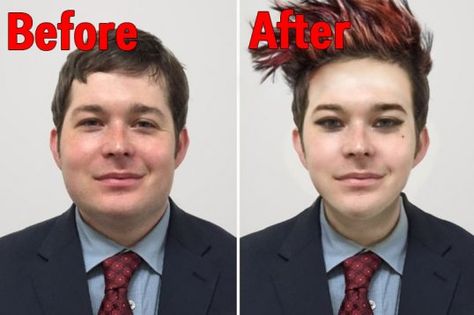 before after geoff g dragon South Korean Plastic Surgery, Plastic Surgery Office, Korean Fashion Teen, Plastic Surgery Clinic, Korean Plastic Surgery, Facial Rejuvenation, K Pop Star, The Writer, Cover Songs