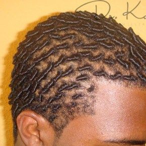 Starting Dreads With Short Hair, Male Starter Locs, Tiny Locs, Starter Dreads, Start Locs, Starting Locs, Men Twist, Men Locs, Dreads Short Hair