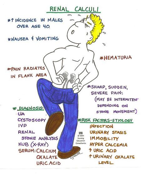 I'm pretending to be studying for my renal exam tomorrow by pinning things about the renal system Renal Calculi, Nursing Study Tips, Nursing Information, Kidney Pain, Nursing Board, Urinary System, Med Surg Nursing, Nursing Mnemonics, Surgical Nursing