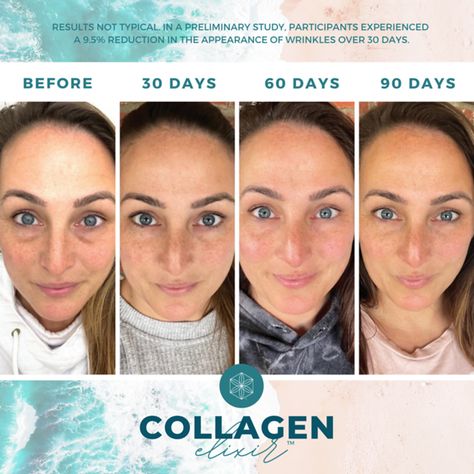 Before and After Images and Templates - Isagenix Collagen Elixir, Nail Vitamins, Collagen Fibers, Vitamin C And Zinc, Erase Wrinkles, Below The Surface, Marine Collagen, Isagenix, Layers Of Skin