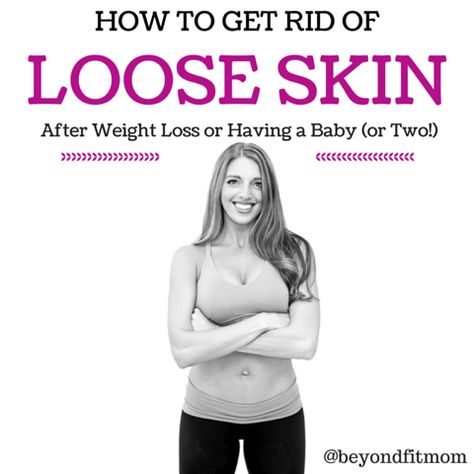 Are you struggling with loose skin after weight loss? Get my five tips on how to get rid of loose skin here! Get Rid Of Loose Skin, After Baby Workout, Skin Tightening Stomach, Baby Workout, Excess Skin, Diastasis Recti, Loose Skin, After Baby, Life Tips